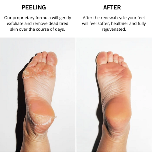 How Does Foot Peel Mask Work