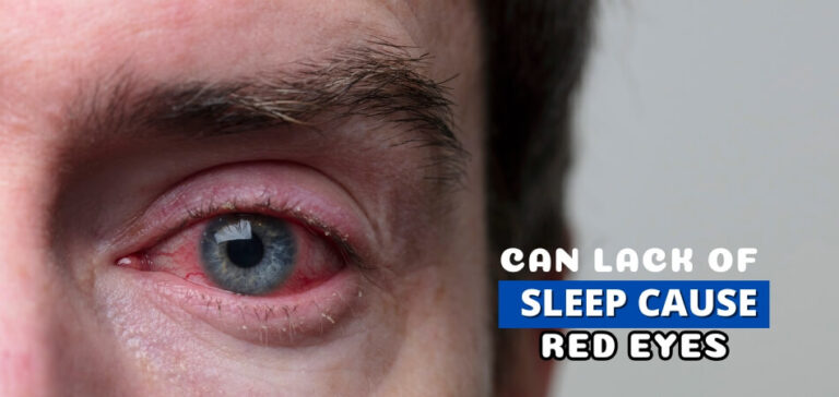 can-lack-of-sleep-cause-red-eyes