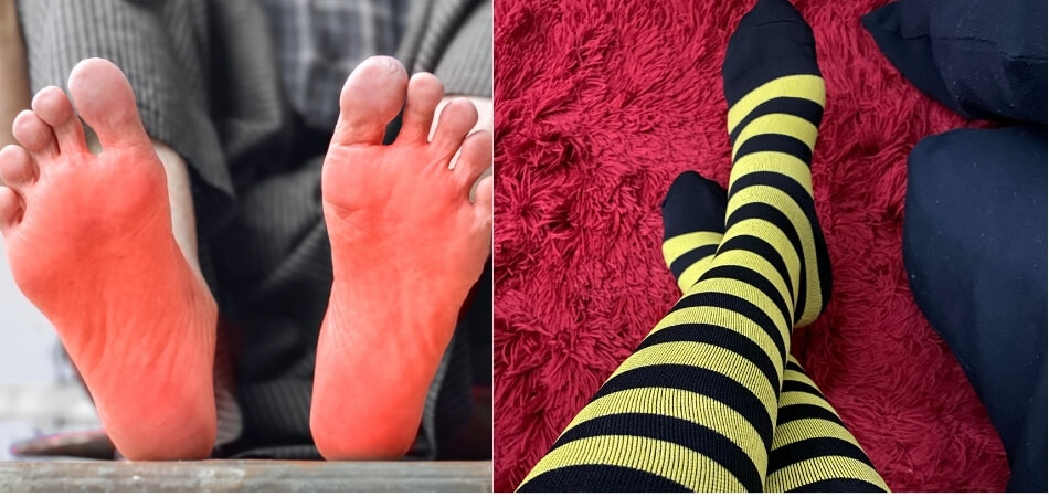 Do Compression Socks Help With Numb Feet