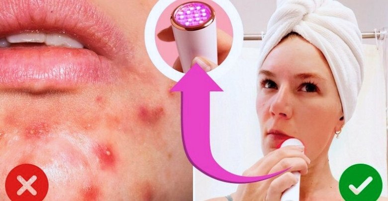 How LED Light Therapy Works on Your Skin A Closer Look