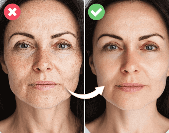 My Results After a Few Weeks of Use (Honest Review)