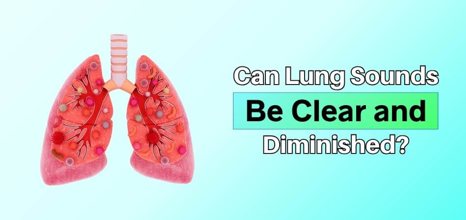 Can Lung Sounds Be Clear and Diminished