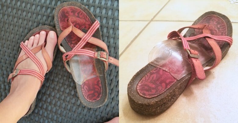 Should You Use Arch Support Insoles for Your Feet