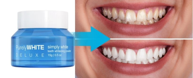 Complete User Review (Personal Experience)