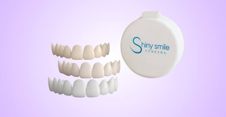 Pricing of Shiny Smile Veneers