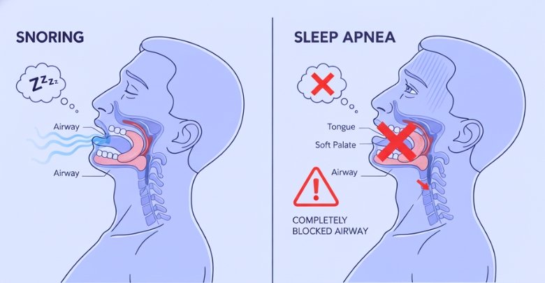 Understanding the Connection Between Snoring and Sleep Apnea