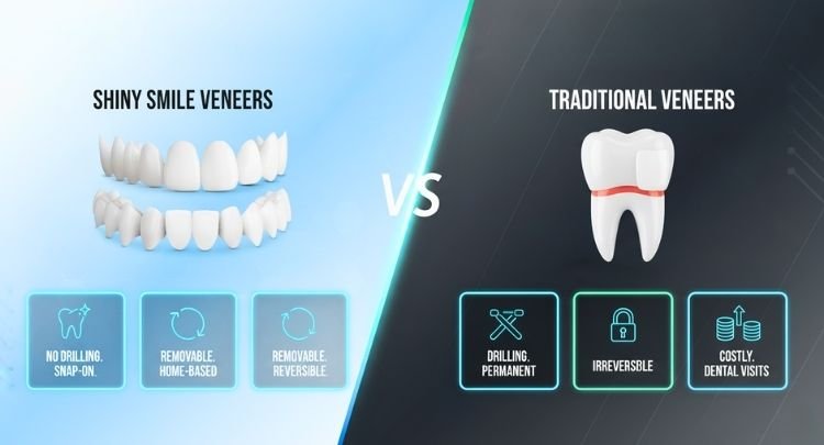 How Shiny Smile Veneers Differ from Traditional Dental Veneers