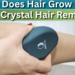 How Does Hair Grow Back After Crystal Hair Removal