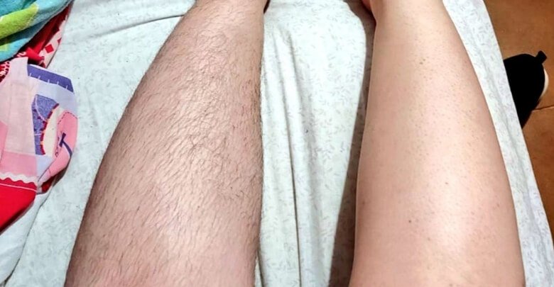 Why Does Regrowth Feel Softer or Rougher After Crystal Hair Removal