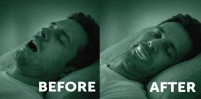 Who Should Try SnoreRX