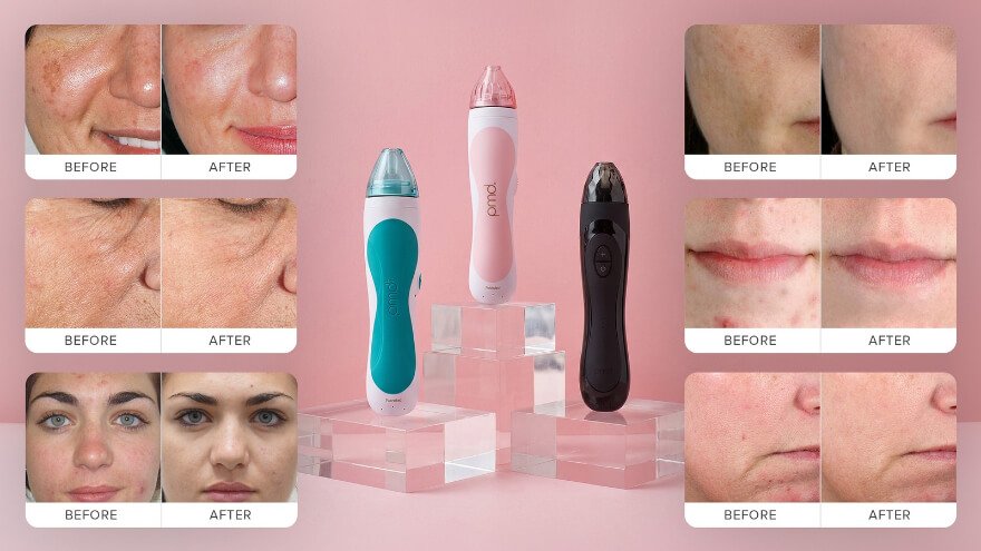 What Skin Problems Can PMD Microderm Help With_